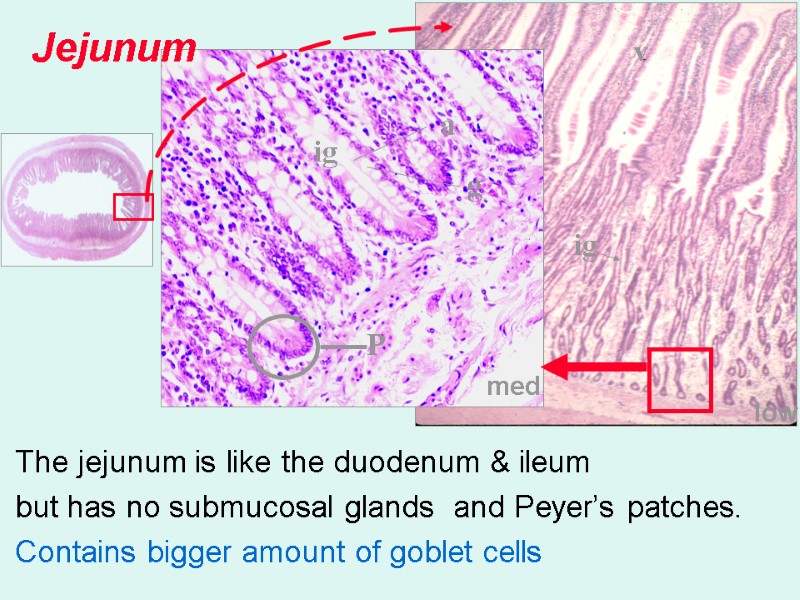 med low Jejunum The jejunum is like the duodenum & ileum  but has